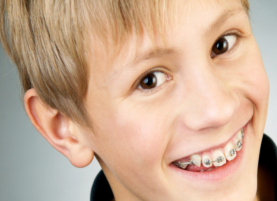 Muaks dental care, crowns. Rodrigo Castillo Muaks dental care, crowns. Rodrigo Castillo